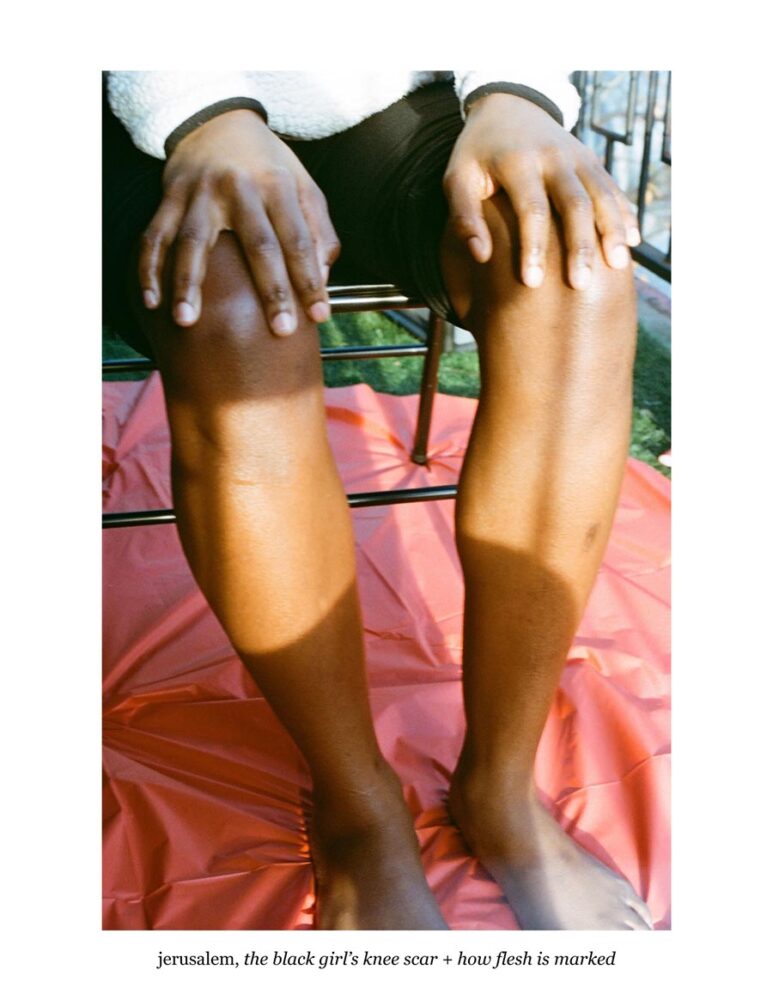 Jerusalem, the black girl’s knee scar + how flesh is marked